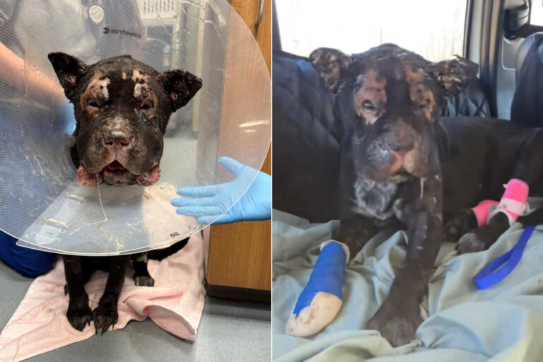 Gravemente ustionato dopo l’esplosione di una bombola di ossigeno, Boden sta affrontando un lungo percorso di guarigione grazie alle cure e all’amore di un team speciale.